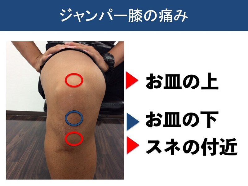 ジャンパー膝を防ぐ 岡野 良介 Note ジャンパー膝を防ぐ 岡野 良介 Note