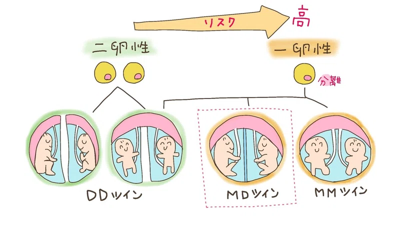 双子妊娠は異常妊娠 総合病院への紹介状 ゆっぴー Note