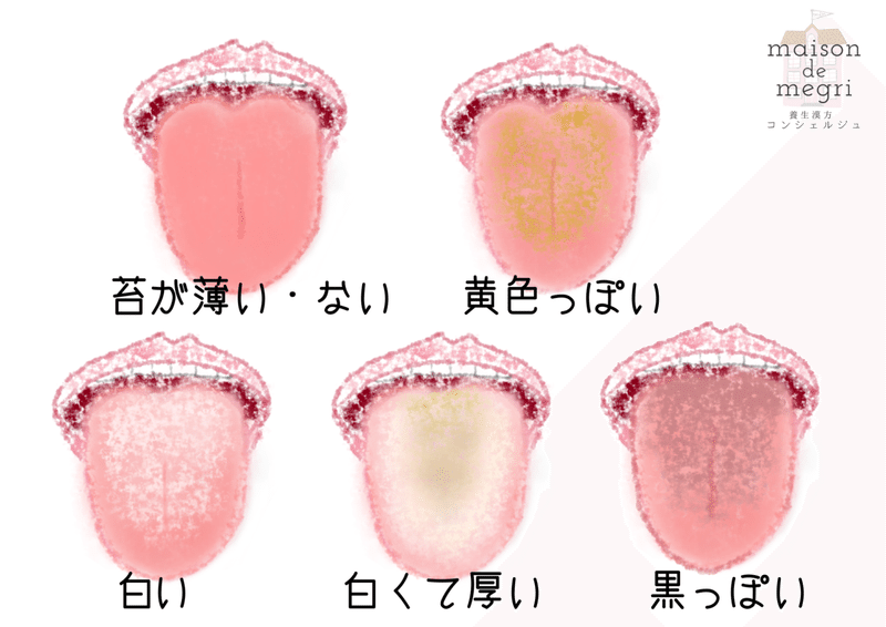 舌の苔が気になる 磨かずとも改善します ワタシスキャン 036 Maison De Megri のnote 養生漢方コンシェルジュ Note 舌の苔が気になる 磨かずとも改善します ワタシスキャン 036 Maison De Megri のnote 養生漢方コンシェルジュ Note