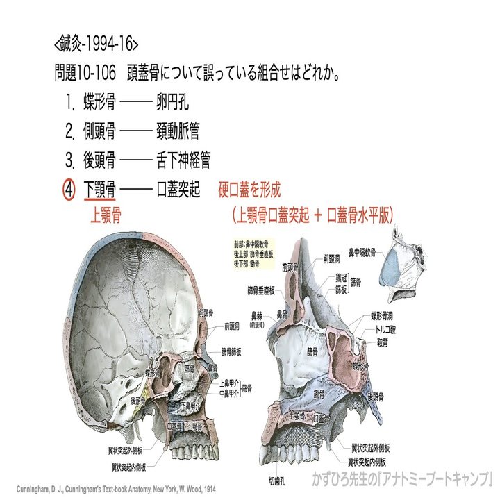 今日のプチ解剖：頭蓋骨について誤っている組合せは？｜かずひろ先生