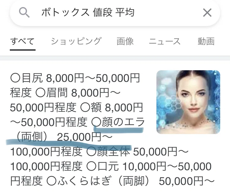 歯ぎしり 食いしばりに悩んできた僕がボトックス注射を打った話 Node Note