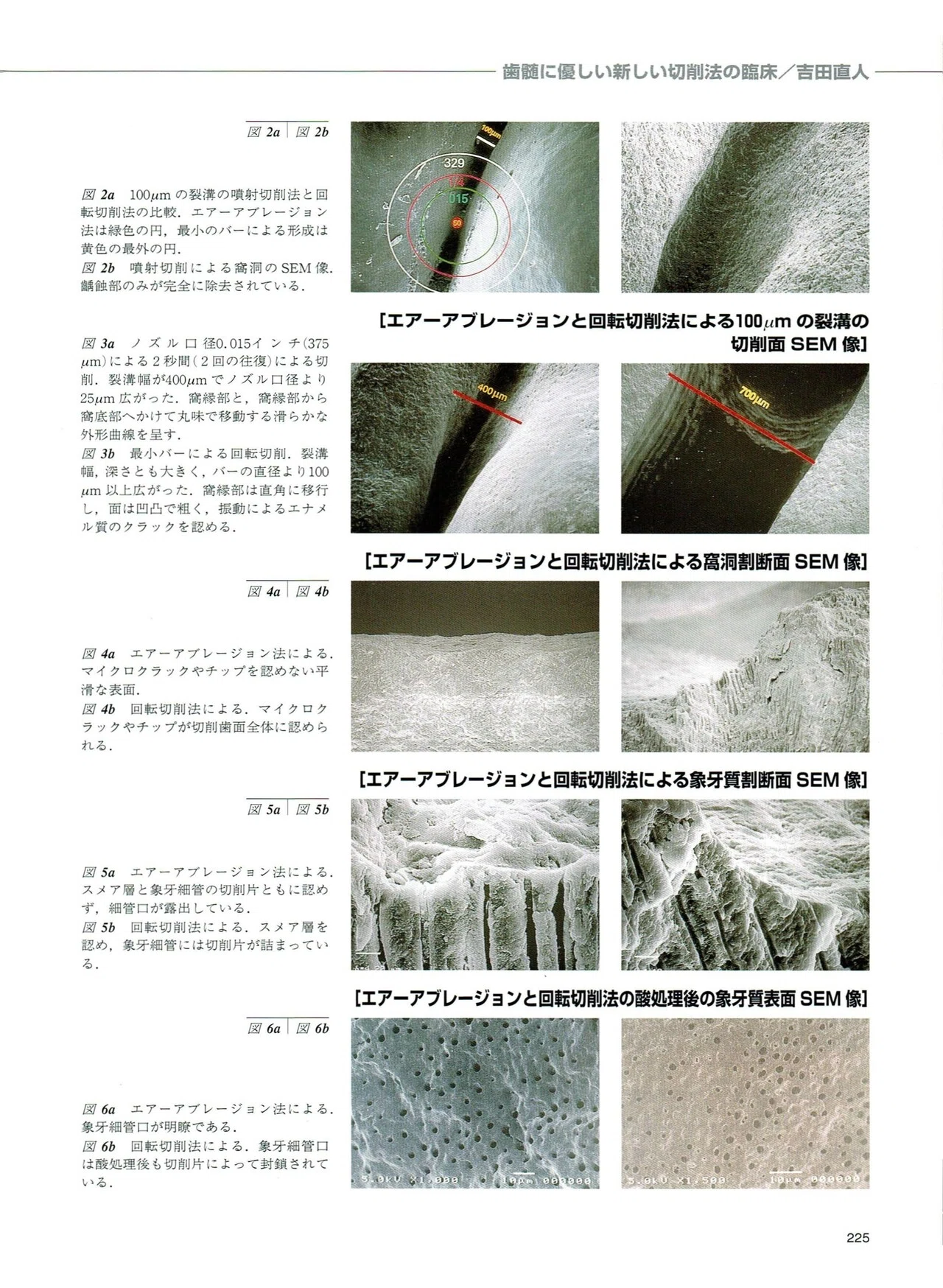 Minimal Intervention Dentistry: Clinical Application of a New Pulp ...