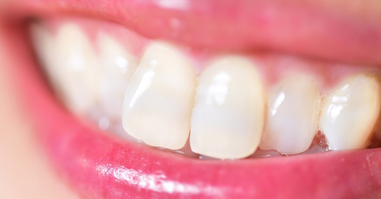 印刷可能 歯ぎしり 彼女 歯ぎしり 彼女 Muryothink