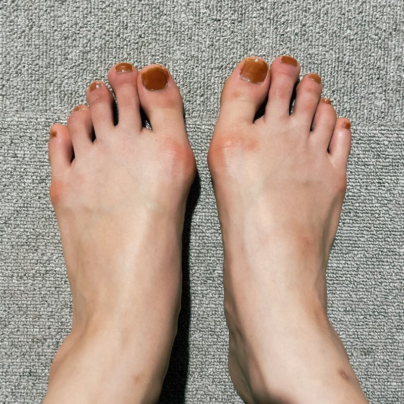 1日目 自力で外反母趾を治せるか ハルカ Nissu Note