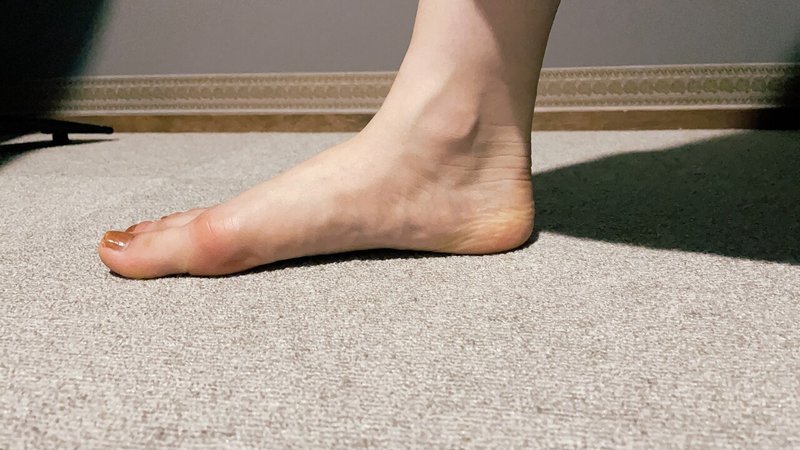 1日目 自力で外反母趾を治せるか ハルカ Nissu Note