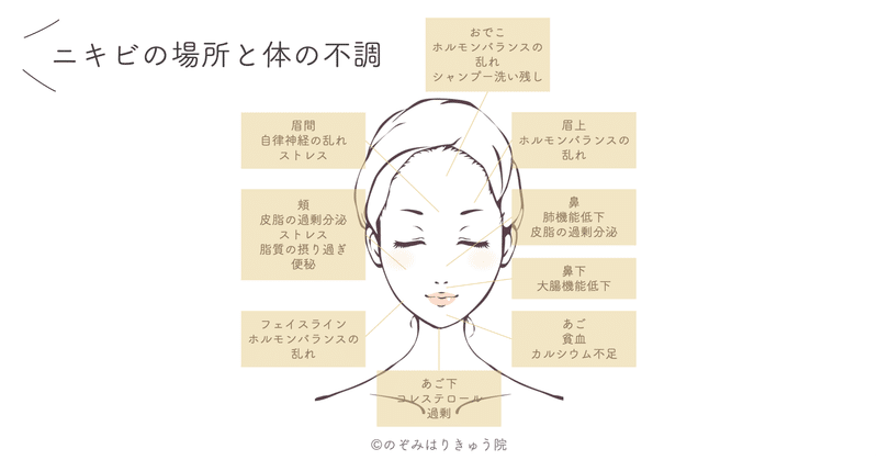 Q 顎 あご にニキビができやすい原因は のぞみはりきゅう院 Note Q 顎 あご にニキビができやすい原因は のぞみはりきゅう院 Note