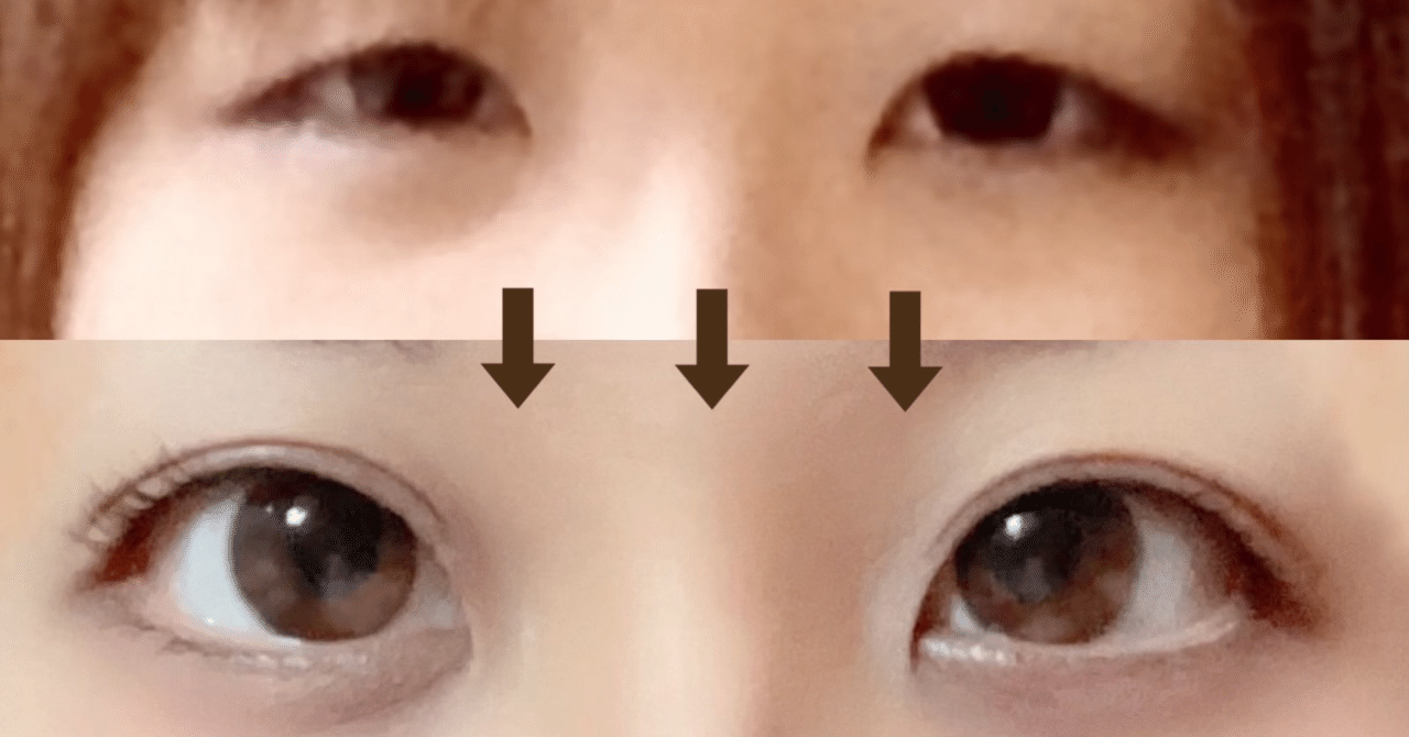 まつ育 Egutamでまつげめっちゃ伸びた まつ育をする際のポイント 超超超オススメのナチュ盛りマスカラの紹介まで まちゅろぐ