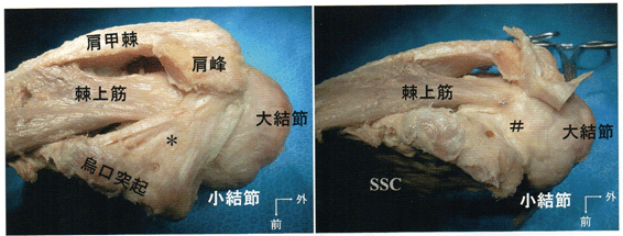 肩関節・肩甲帯 (最新整形外科学大系) 商品詳細ページ | メディカルブックセンター