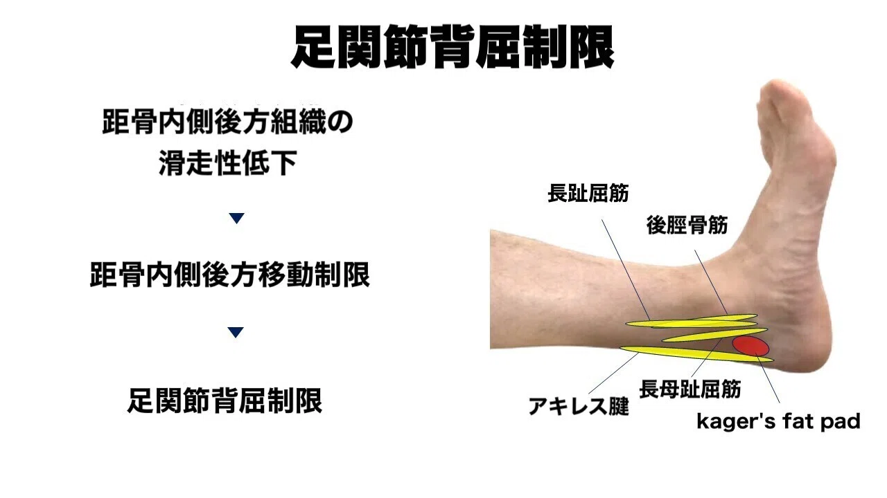 アキレス腱障害｜➁ 可動域改善｜L-fit.