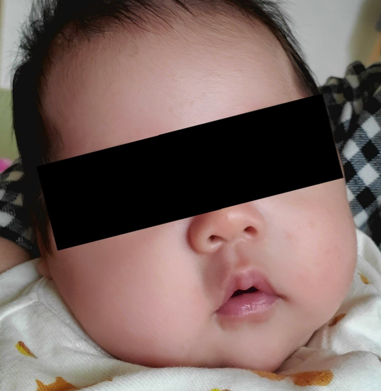 乳児湿疹対策 Shellm Note 乳児湿疹対策 Shellm Note