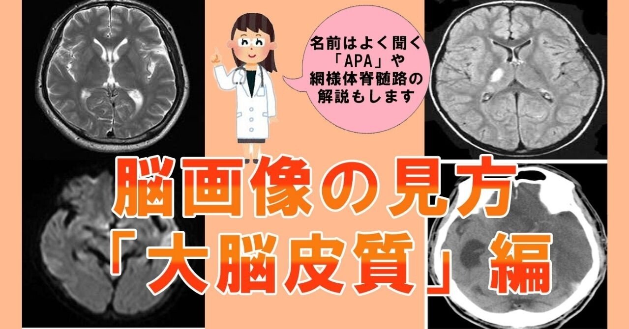 療法士向け 脳画像の見方 大脳皮質中心に と脳 内の運動の経路について いと オールラウンド理学療法士 アフィリエイト Web制作で月10万稼いでます Note