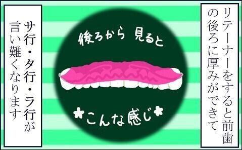 歯科矯正治療（後編）50 【リテーナー生活02】 リテーナー装着時の滑舌-1