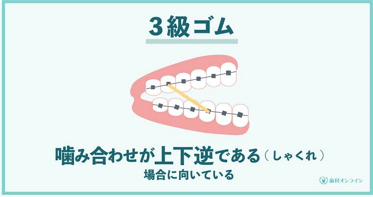 自称統括リーダーの彼女が退院するまで 術後7日目 退院編 妖精お兄さん Note 自称統括リーダーの彼女が退院するまで 術後7日目 退院編 妖精お兄さん Note
