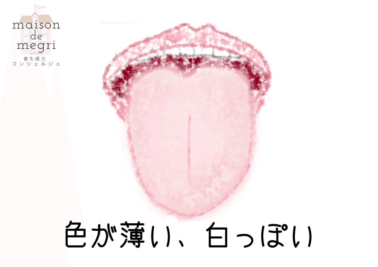 舌でみつける、ワタシの養生②【ワタシスキャン＋】｜maison de megri 
