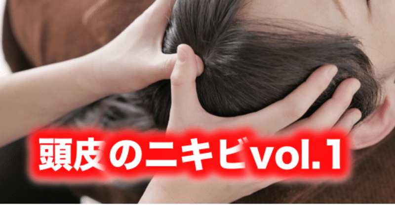 頭皮のニキビvol 1 片柳ちひろ ニキビ博士 Note 頭皮のニキビvol 1 片柳ちひろ ニキビ博士 Note