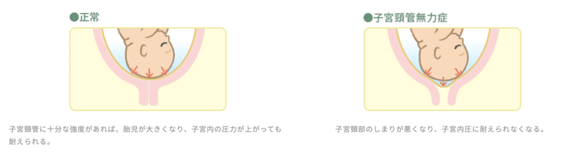 切迫早産で奥さんが入院したパパへ Takuya Oka Note