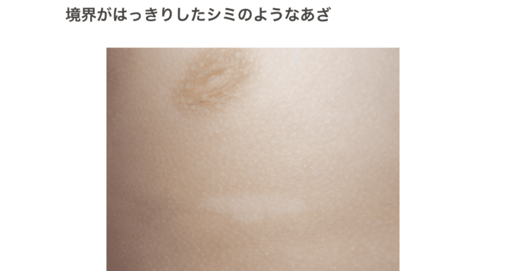 白斑 ॽ ゆま Note 白斑 ॽ ゆま Note