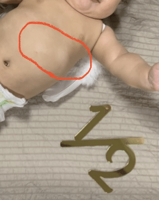 白斑 ॽ ゆま Note 白斑 ॽ ゆま Note