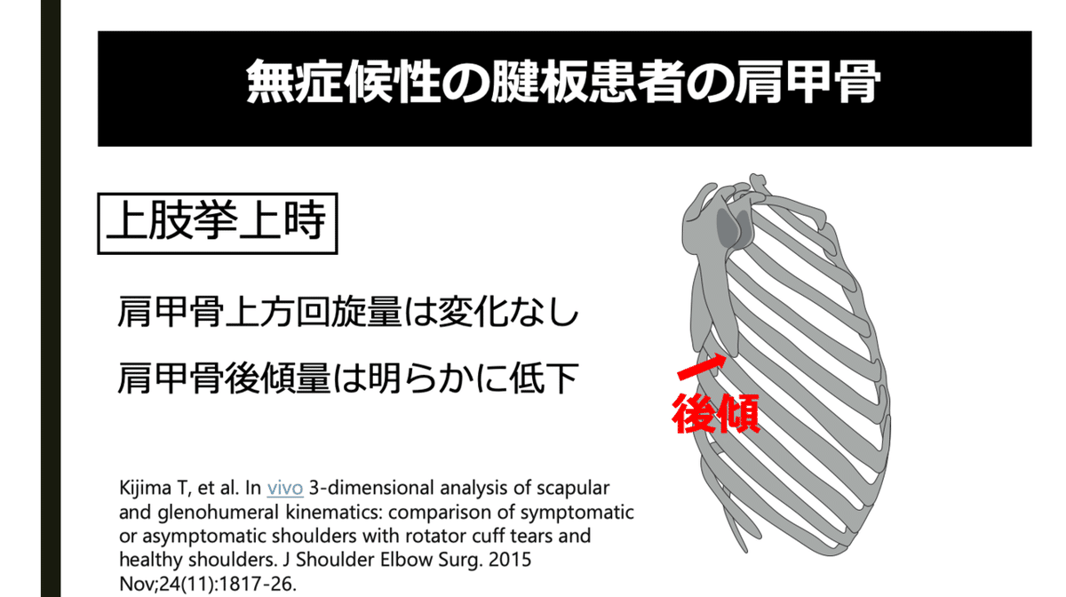 無症候性腱板断裂の肩甲骨