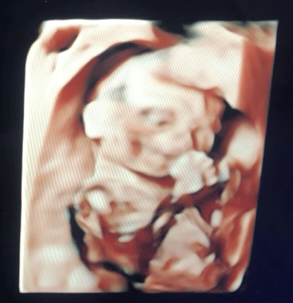 はじめての4dエコー 妊娠21週 みとぴちゃん Note はじめての4dエコー 妊娠21週 みとぴちゃん Note