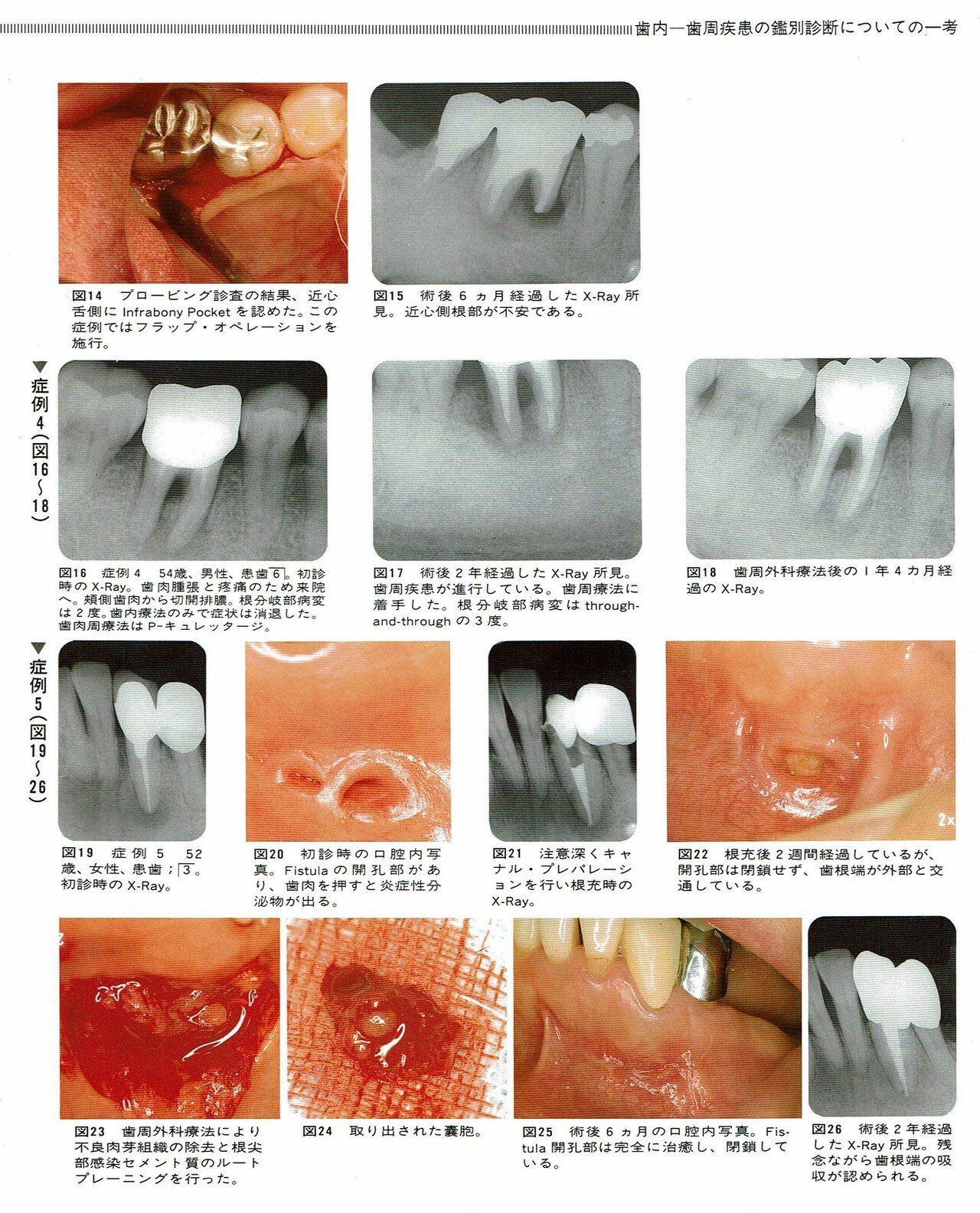 口腔内科学 医薬部外品】ジェクス ラクレッシュ EX薬用液体ハミガキ L8020