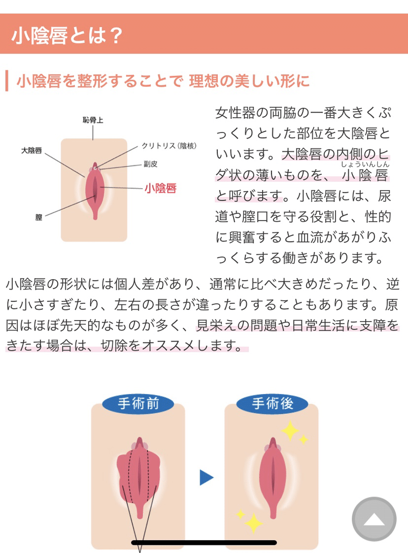 婦人科形成手術 2 ミューレ Note 婦人科形成手術 2 ミューレ Note
