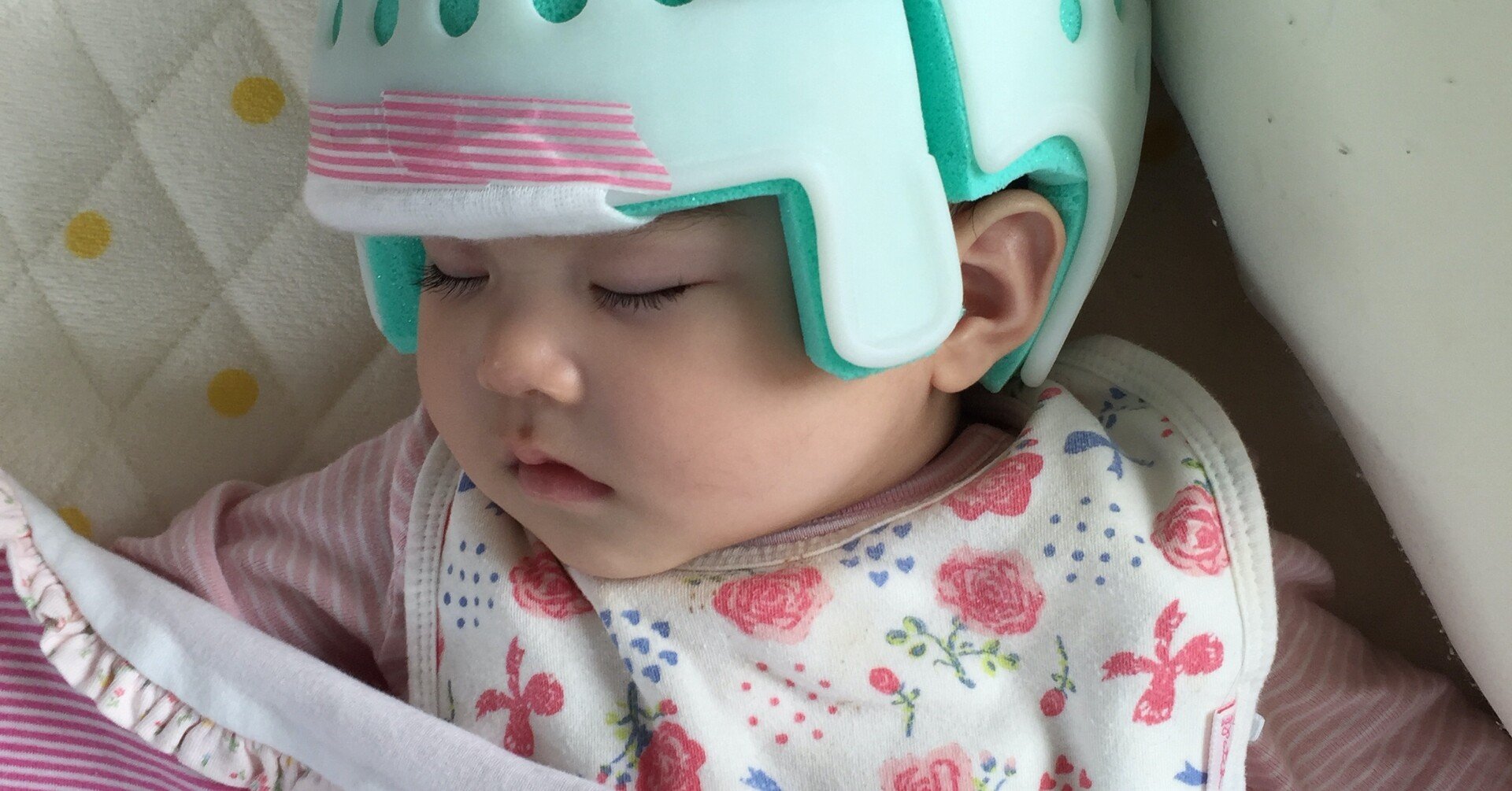 長女はヘルメットをしていました これから赤ちゃんを育てる方に 頭を丸く育てることをお勧めしたい 熊崎友香 ナレーター Note 長女はヘルメットをしていました これから赤ちゃんを育てる方に 頭を丸く育てることをお勧めしたい 熊崎友香 ナレーター Note