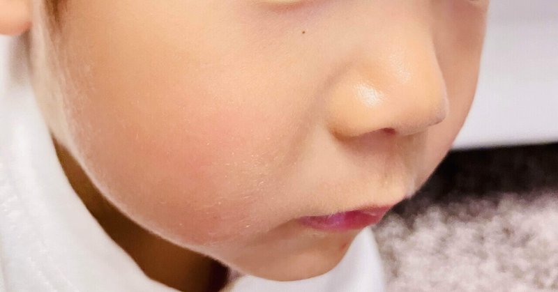 息子の顔にほくろ出現 わかじ Note 息子の顔にほくろ出現 わかじ Note