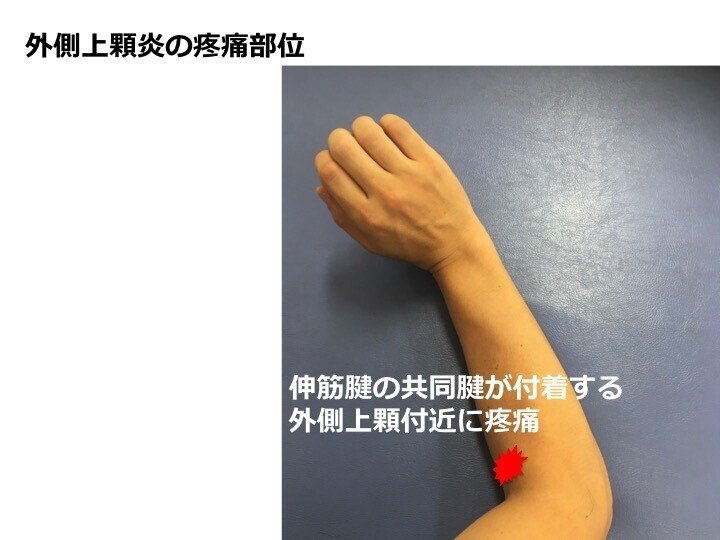 付着部