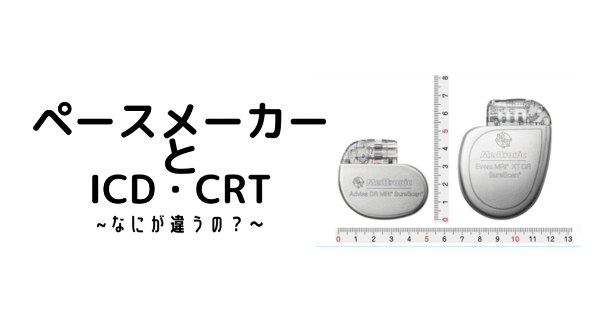 ペースメーカとICD・CRT 〜なにが違うの?〜|WING先輩 ペースメーカとICD・CRT 〜なにが違うの?〜|WING先輩