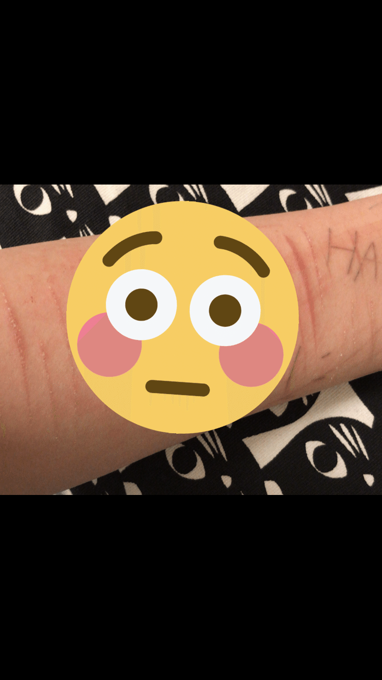 うわああああああ ハウルの動く城見たりして我慢したのに 結局切ってしまった しかもなかなか深め 自分は本当にダメなんだ ミザリー Misery Note
