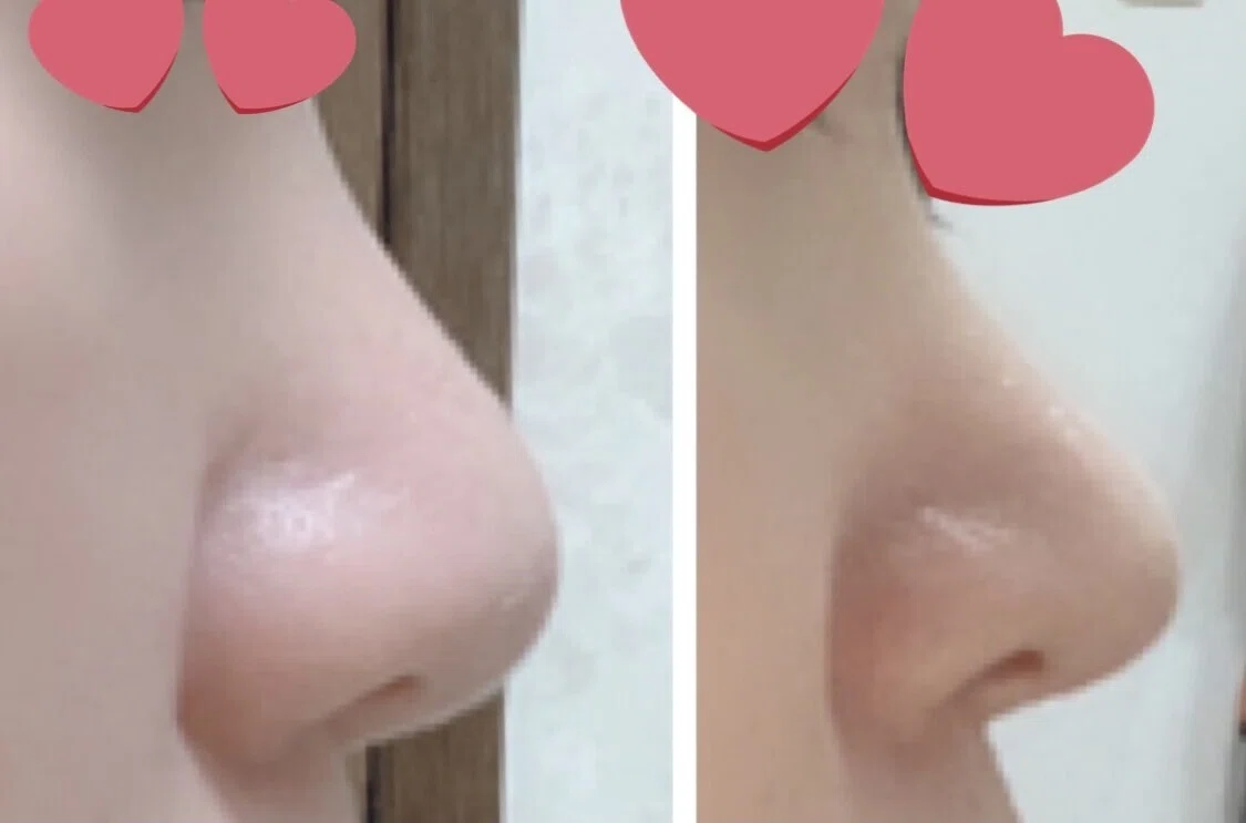 画像11