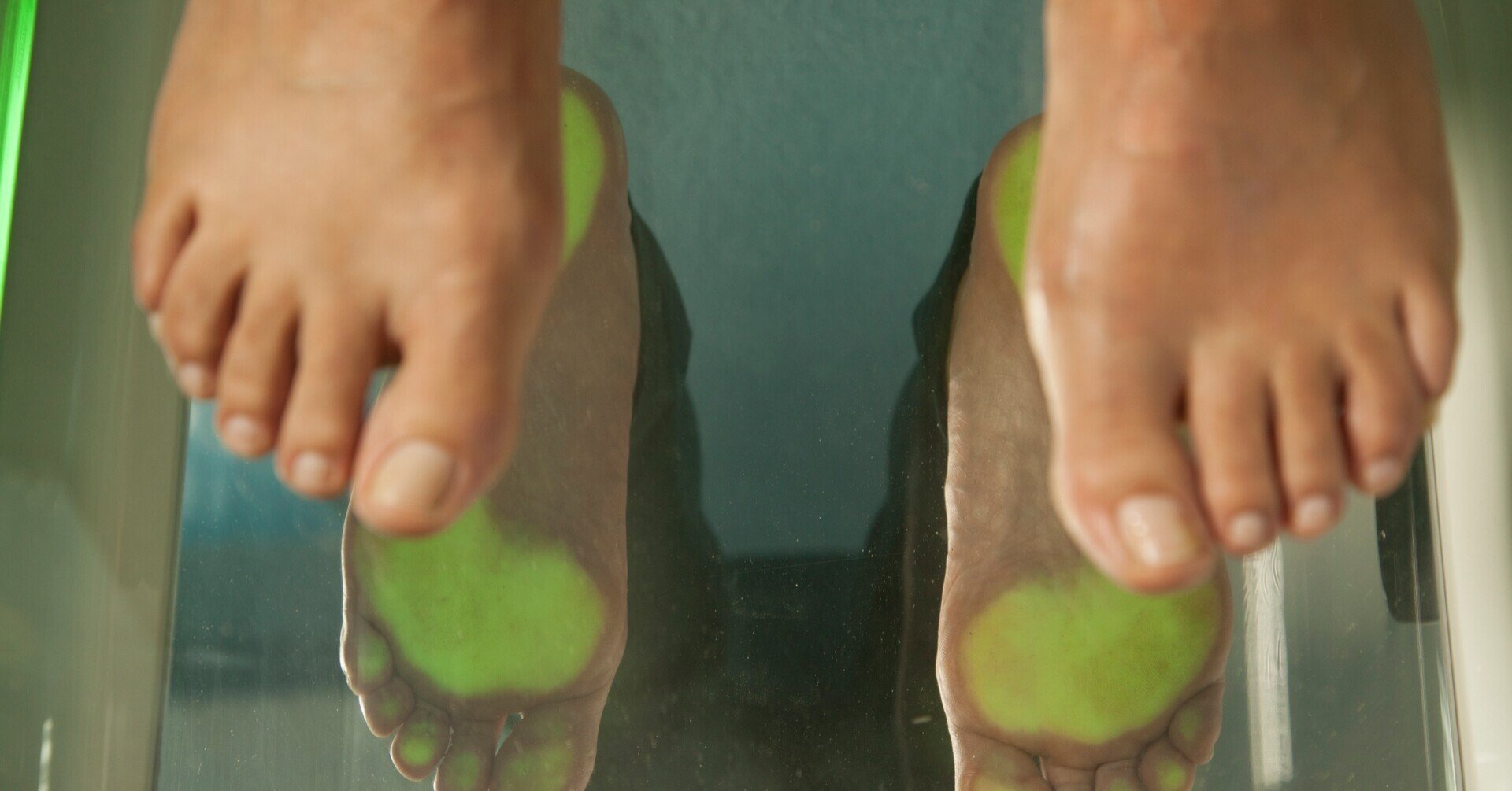 スケーターの足の悩み 足の大きさが左右で違う スケートインソール株式会社 Note スケーターの足の悩み 足の大きさが左右で違う スケートインソール株式会社 Note