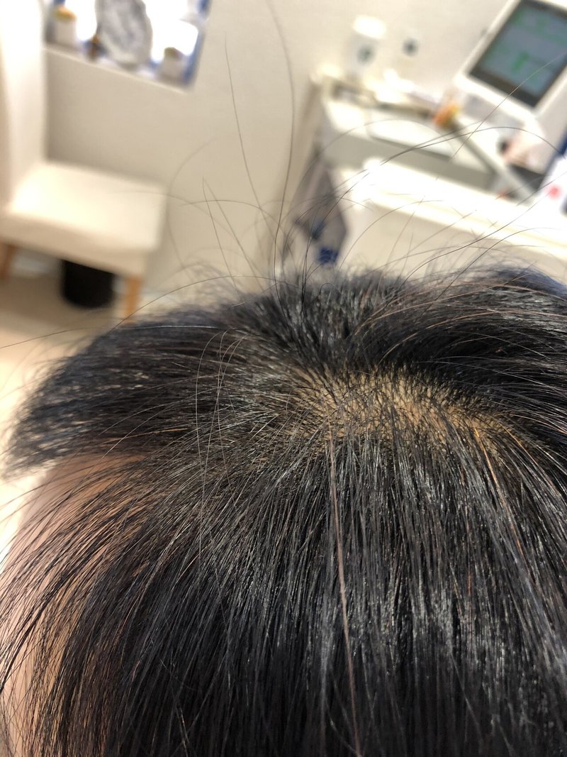 前髪が成長してくれてる 株 H Feel 酒井智章のnote Note 前髪が成長してくれてる 株 H Feel 酒井智章のnote Note
