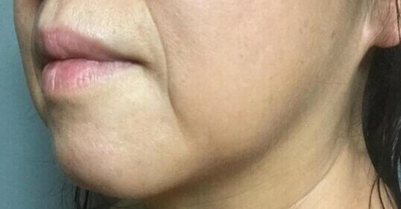 プチ整形失敗 の新着タグ記事一覧 Note つくる つながる とどける