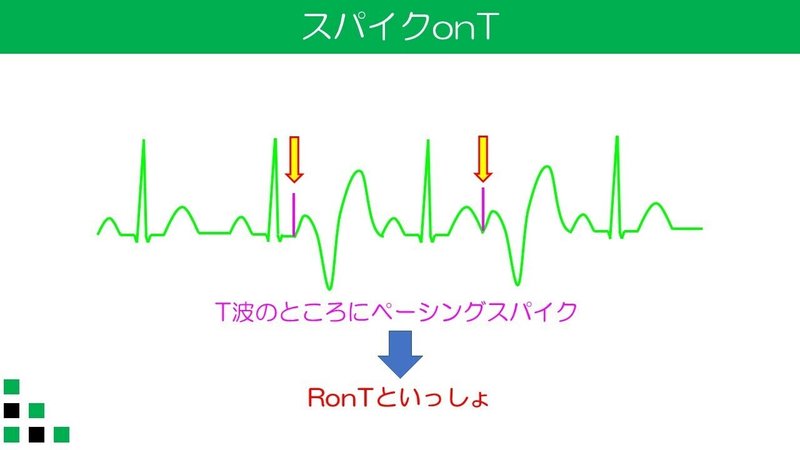 スパイクonＴ　RonTと一緒の図