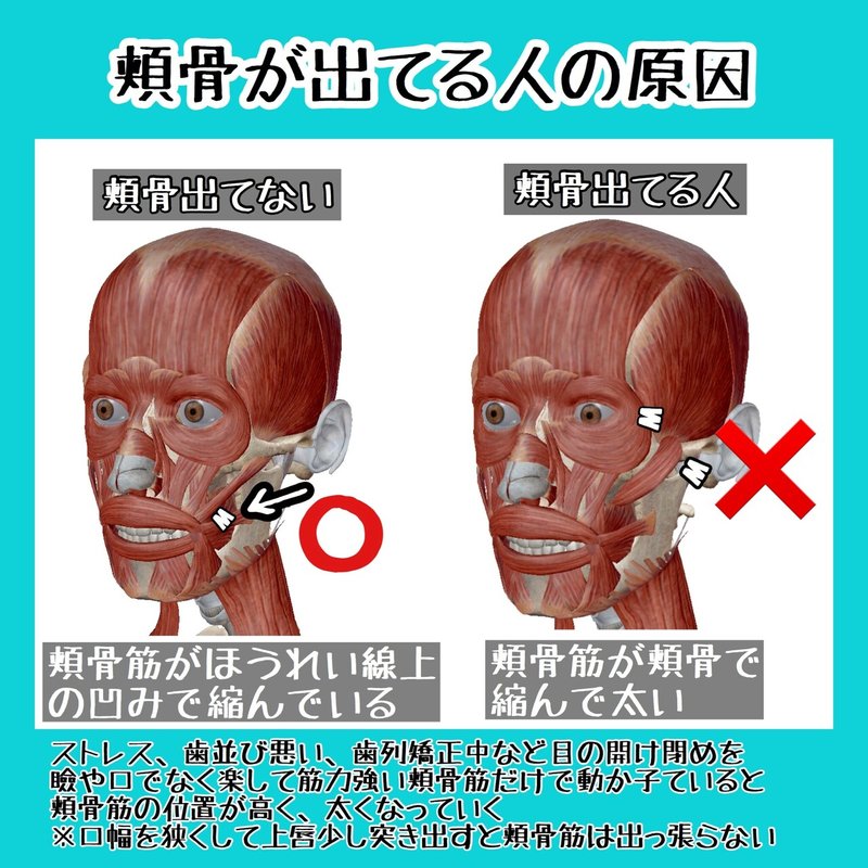 頬骨を引っ込める方法 自分で頬骨矯正のやり方 お顔の整体師 戸塚哲春 Note