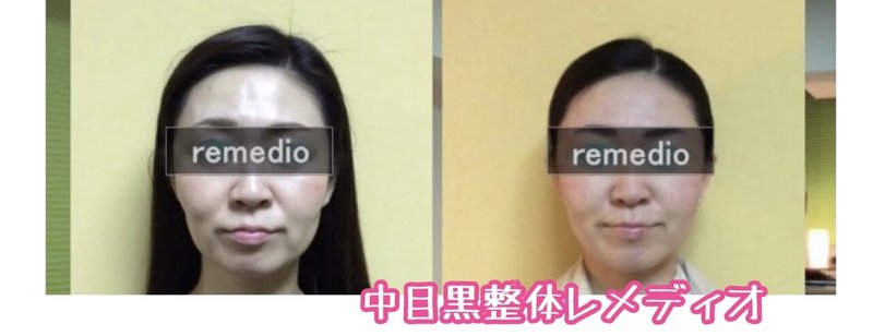 頬骨を引っ込める方法 自分で頬骨矯正のやり方 お顔の整体師 戸塚哲春 Note 頬骨を引っ込める方法 自分で頬骨矯正のやり方 お顔の整体師 戸塚哲春 Note