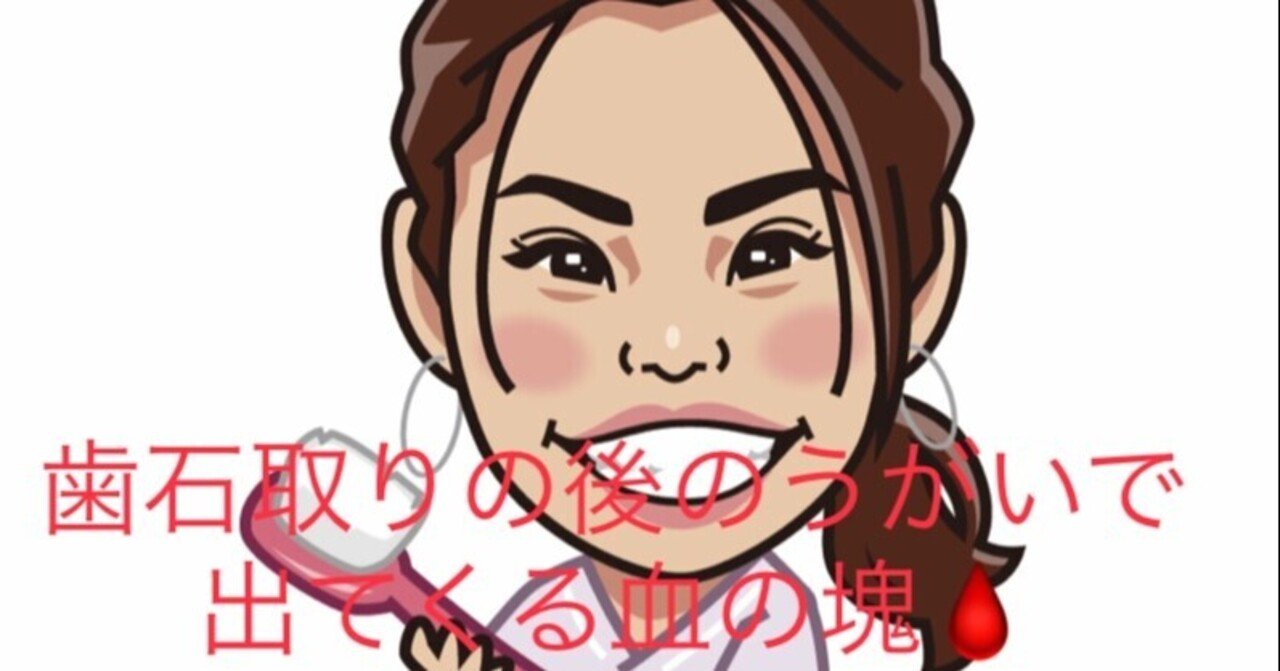 歯石取りの後のうがいで出てくる血の塊 オクチノニオイ柳澤弘子 歯科衛生士 Note