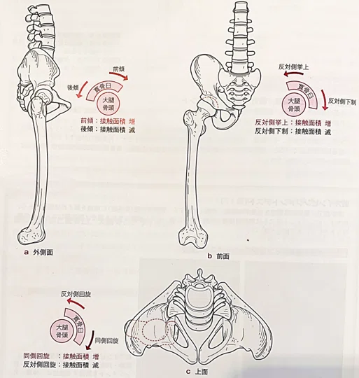 股関節痛の理学療法〜骨頭求心位獲得のための評価とアプローチ〜｜理学