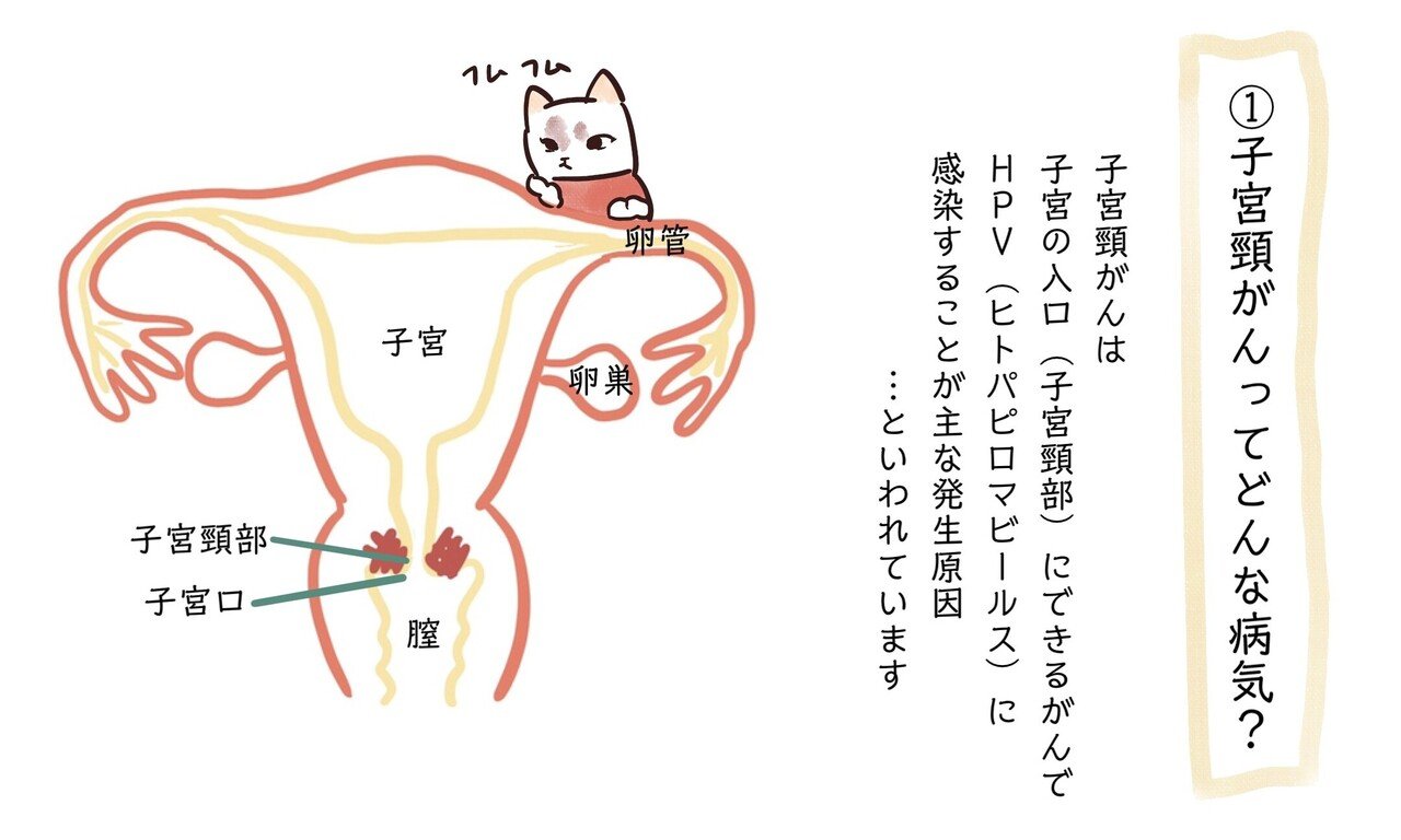 私が35才で子宮頸がんを寸止めできた話⑤｜ゆきびっち
