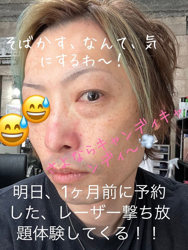 シミ取り放題 そばかす経過報告 Hiro美容師 特殊ヘア美容講師 フリーランス プライベートシェアサロン アニメ好き 大阪兵庫姫路 Note シミ取り放題 そばかす経過報告 Hiro美容師 特殊ヘア美容講師 フリーランス プライベートシェアサロン アニメ好き 大阪兵庫姫路 Note