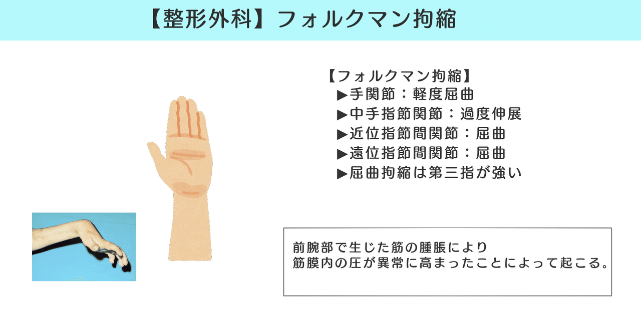 整形外科 図解 イラスト とゴロで簡単 フォルクマン拘縮 の覚え方 森元塾 国家試験対策 Note 整形外科 図解 イラスト とゴロで簡単 フォルクマン拘縮 の覚え方 森元塾 国家試験対策 Note
