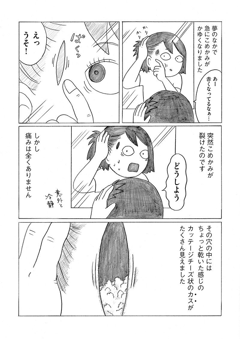 イボイボの世界 第18話 穴と耳かきと私 コココミ Note