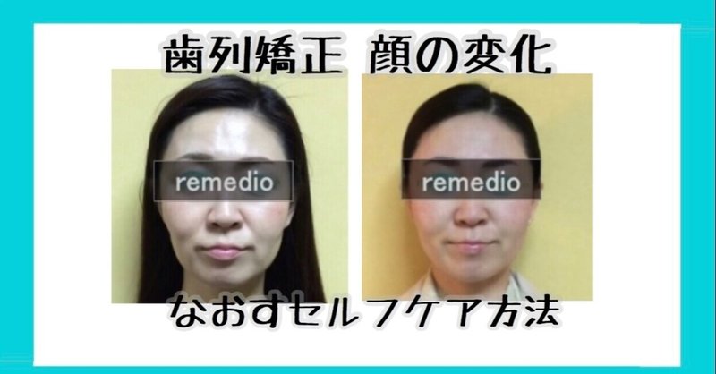 歯列矯正 顔の変化 表情筋セルフケア方法 お顔の整体師 戸塚哲春 Note