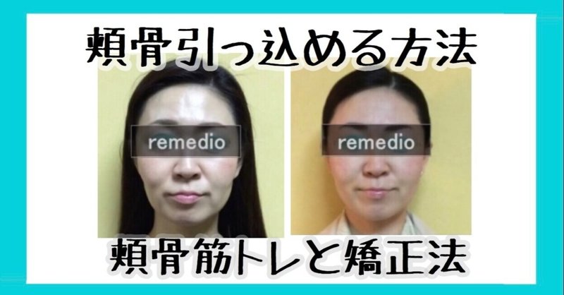 頬骨を引っ込める方法 自分で頬骨矯正のやり方 お顔の整体師 戸塚哲春 Note 頬骨を引っ込める方法 自分で頬骨矯正のやり方 お顔の整体師 戸塚哲春 Note