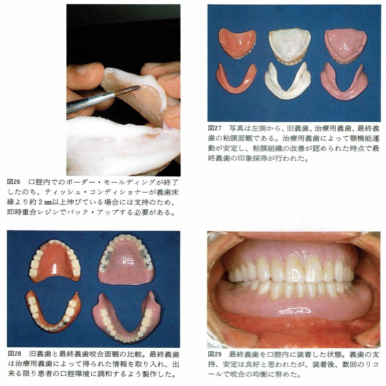 ティッシュ ストア コンディショナー 使い方