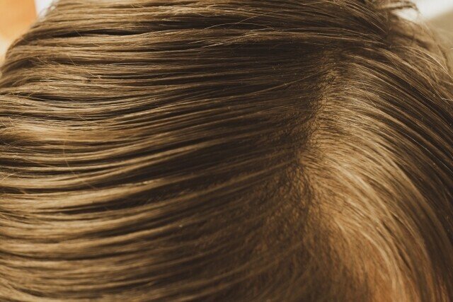 髪質改善は頭皮ケアが大事 季節の変わり目に起こりがちな頭皮のトラブル Hairdesigner ナカセコ ミユキ Note