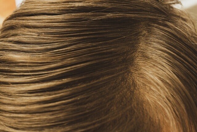 髪質改善は頭皮ケアが大事 季節の変わり目に起こりがちな頭皮のトラブル Hairdesigner ナカセコ ミユキ Note 髪質改善は頭皮ケアが大事 季節の変わり目に起こりがちな頭皮のトラブル Hairdesigner ナカセコ ミユキ Note