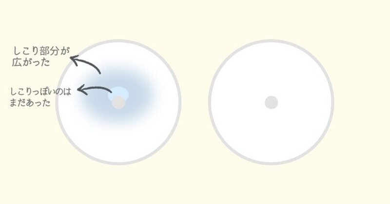 乳腺炎 の治療経過 ちくわ Note